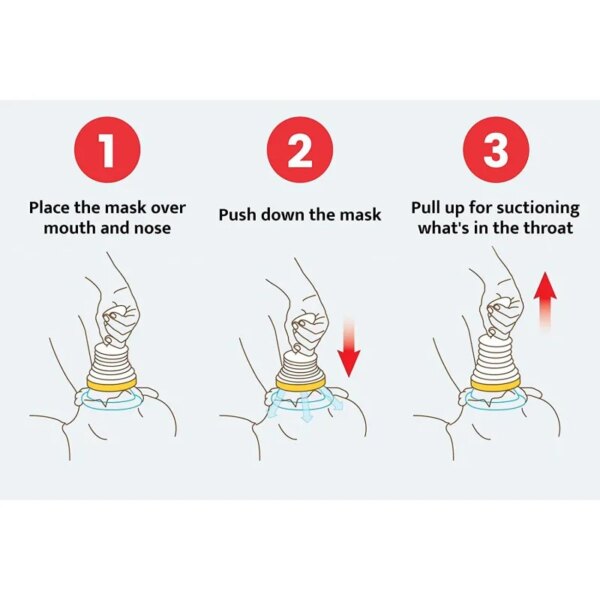 First Aid Kit Emergency Choking Rescue Device Adults Children Choking Help Kits Home Asphyxia Rescues Tool Anti Suffocaation - Image 5